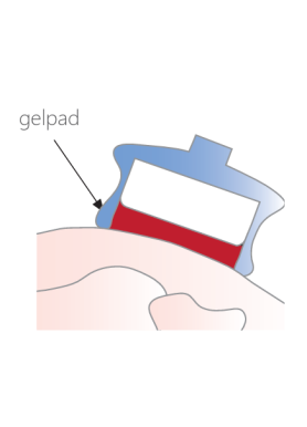 Gelpad StatUS (240x)