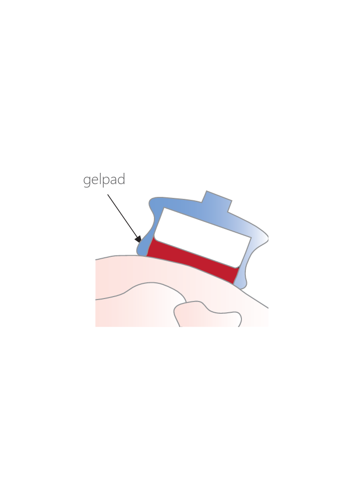 Gelpad StatUS (240x)