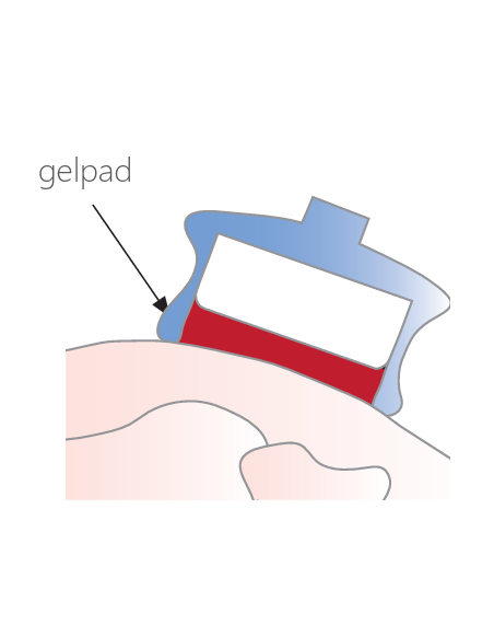 Gelpad StatUS (240x)